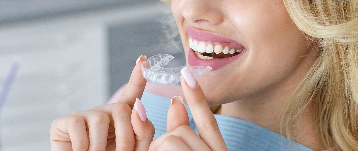 How Does Invisalign Work to Straighten Your Teeth?